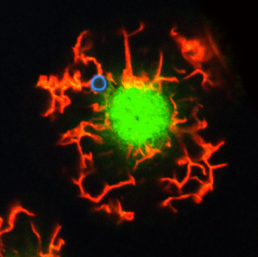 Cryptococcus neoformans